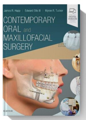 Contemporary Oral and Maxillofacial Surgery 7th