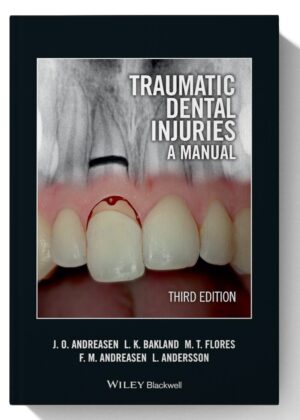 Traumatic Dental Injuries: A Manual 3rd Edition