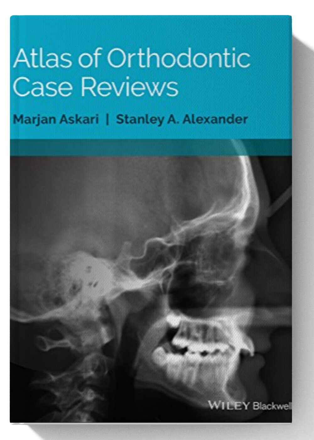 Atlas of Orthodontic Case Reviews 1st Edition