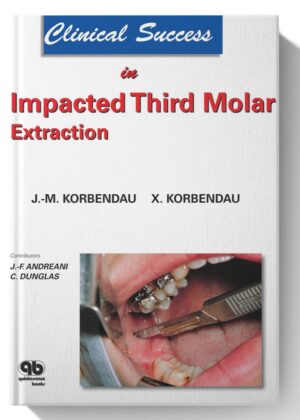 Clinical Success in Impacted Third Molar Extraction 1st Edition