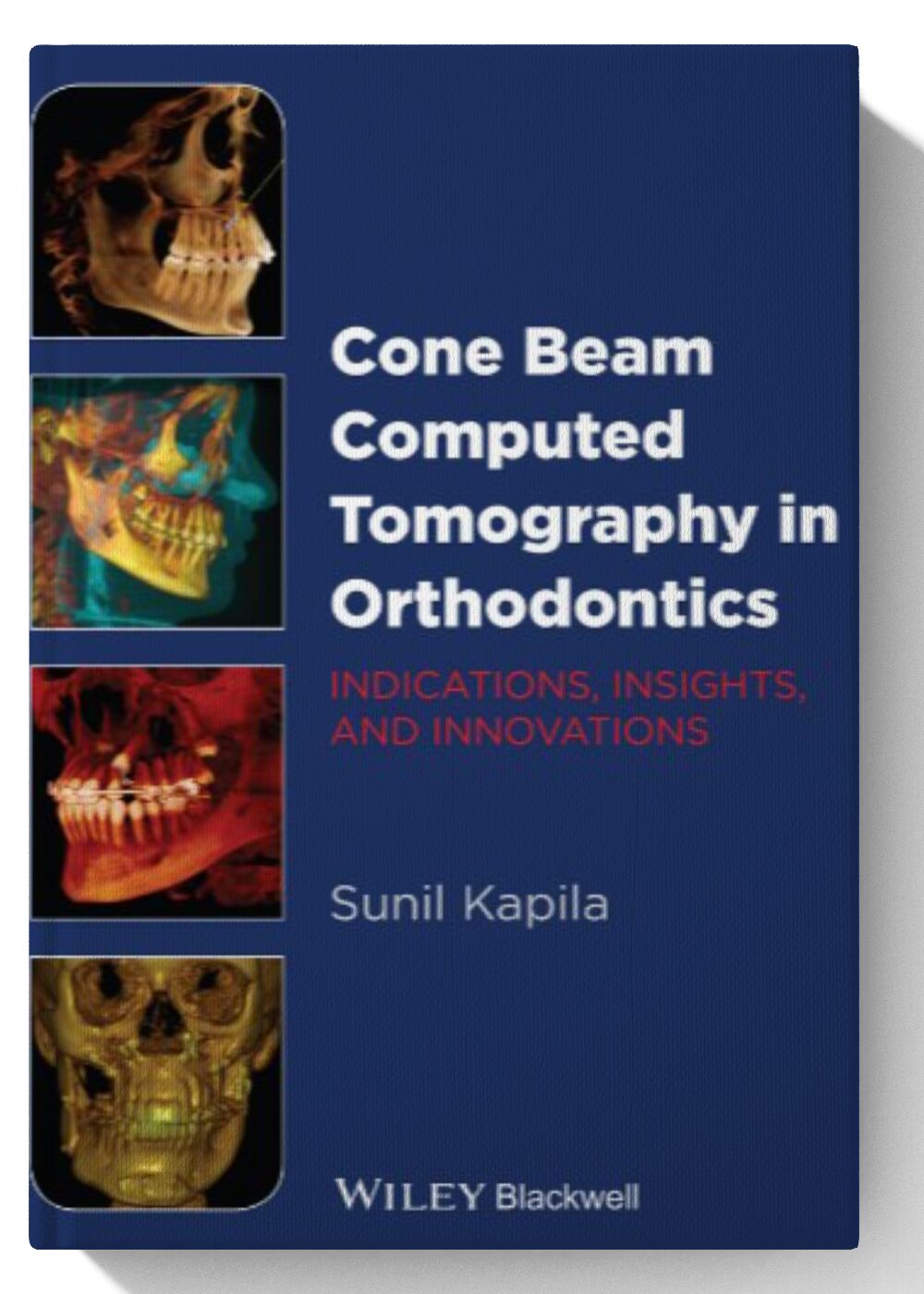 Cone Beam Computed Tomography in Orthodontics: Indications, Insights, and Innovations 1st Edition