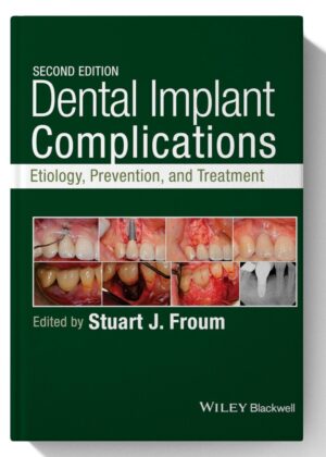 Dental Implant Complications: Etiology, Prevention, and Treatment 2nd Edition