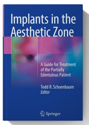 Implants in the Aesthetic Zone: A Guide for Treatment of the Partially Edentulous Patient 1st ed