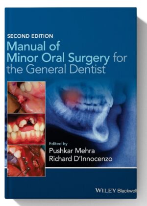 Manual of Minor Oral Surgery for the General Dentist 2nd Edition