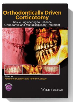 Orthodontically Driven Corticotomy: Tissue Engineering to Enhance Orthodontic and Multidisciplinary Treatment 1st Edition