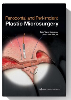 Periodontal and Peri-implant Plastic Microsurgery: Minimally Invasive Techniques with Maximum Precision