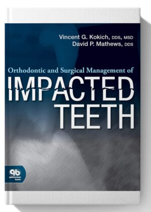 Orthodontic and Surgical Management of Impacted Teeth First Edition