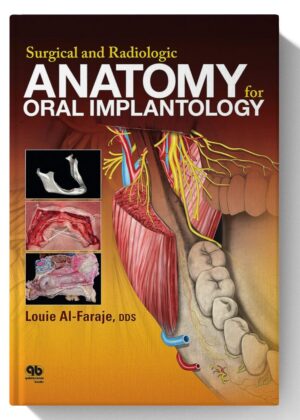 Surgical and Radiologic Anatomy of Oral Implantology 1st edition