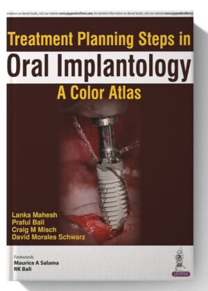 Treatment Planning Steps in Oral Implantology: A Color Atlas