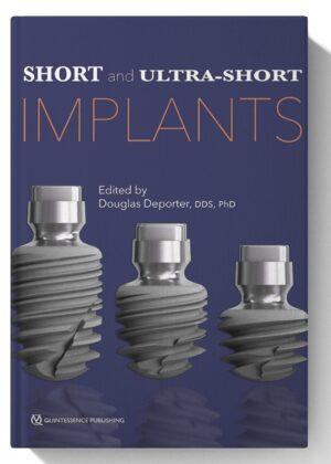 Short and Ultra-Short Implants 1st Edition