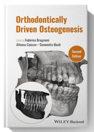 Orthodontically Driven Osteogenesis 2nd Edition