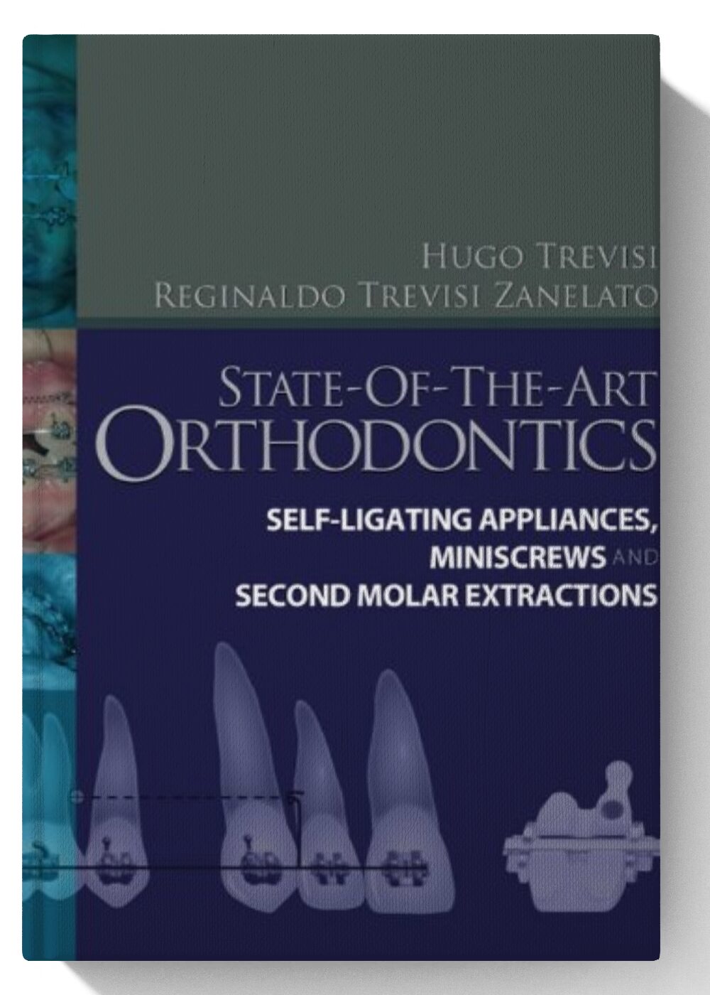 State-of-the-Art Orthodontics E-Book 1st Edition