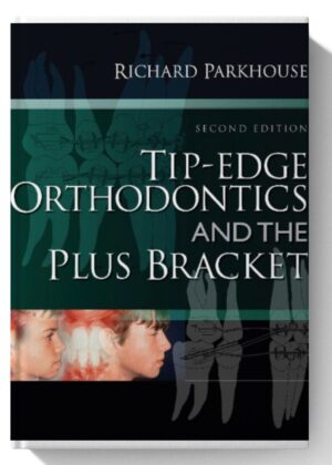 Tip-Edge Orthodontics and the Plus Bracket 2nd Edition