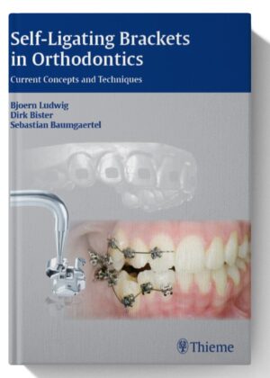 Self-ligating Brackets in Orthodontics: Current Concepts and Techniques 1st Edition