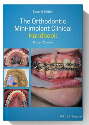 The Orthodontic Mini-implant Clinical Handbook 2nd Edition