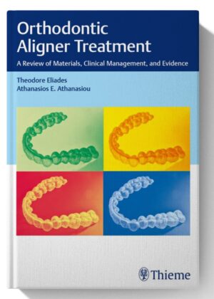 Orthodontic Aligner Treatment: A Review of Materials, Clinical Management, and Evidence 1st Edition