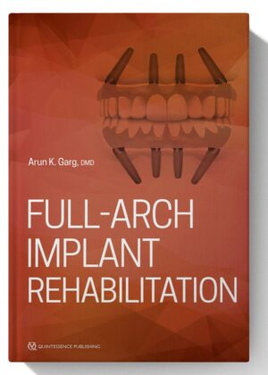 Full-Arch Implant Rehabilitation 1st Edition