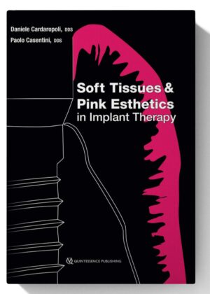 Soft Tissues and Pink Esthetics in Implant Therapy 1st Edition