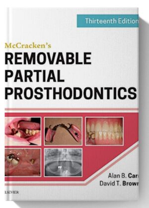 McCracken's Removable Partial Prosthodontics 13th Edition