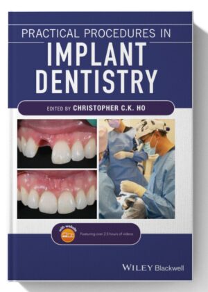 Practical Procedures in Implant Dentistry