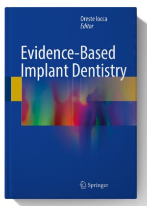 Evidence-based Implant Dentistry