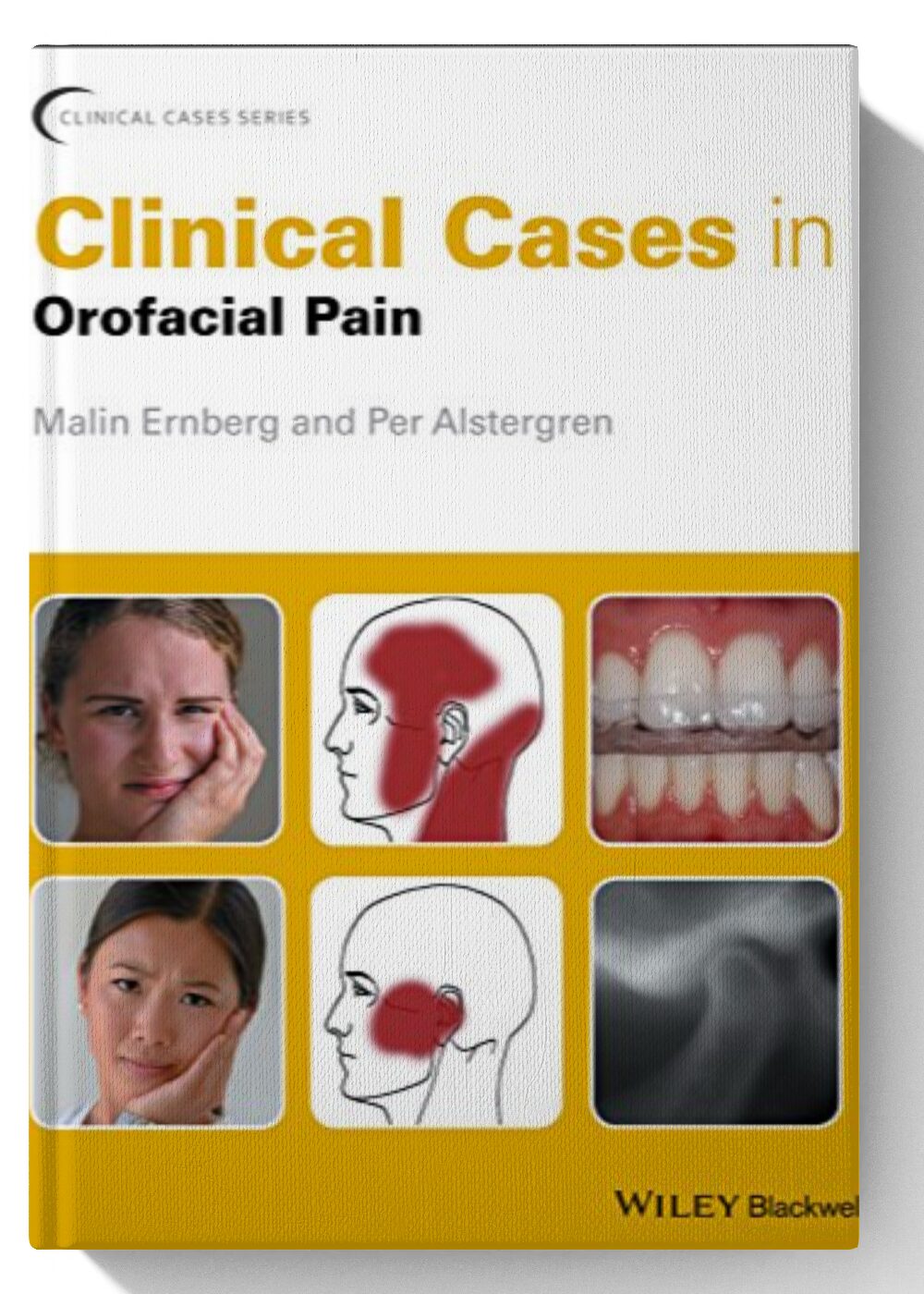 Clinical Cases in Orofacial Pain (Clinical Cases (Dentistry)) 1st Edition