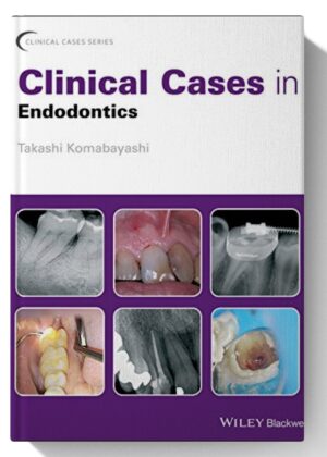 Clinical Cases in Endodontics (Clinical Cases (Dentistry)) 1st Edition