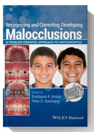Recognizing and Correcting Developing Malocclusions: A Problem-Oriented Approach to Orthodontics 1st Edition