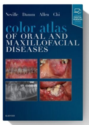Color Atlas of Oral and Maxillofacial Diseases 1st Edition