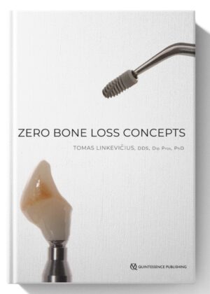 Zero Bone Loss Concepts 1st Edition