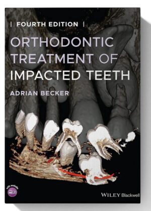 Orthodontic Treatment of Impacted Teeth 4th Edition
