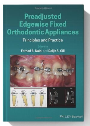 Preadjusted Edgewise Fixed Orthodontic Appliances: Principles and Practice 1st Edition