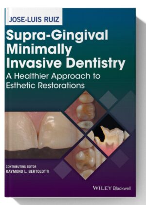 Supra-Gingival Minimally Invasive Dentistry: A Healthier Approach to Esthetic Restorations 1st Edition