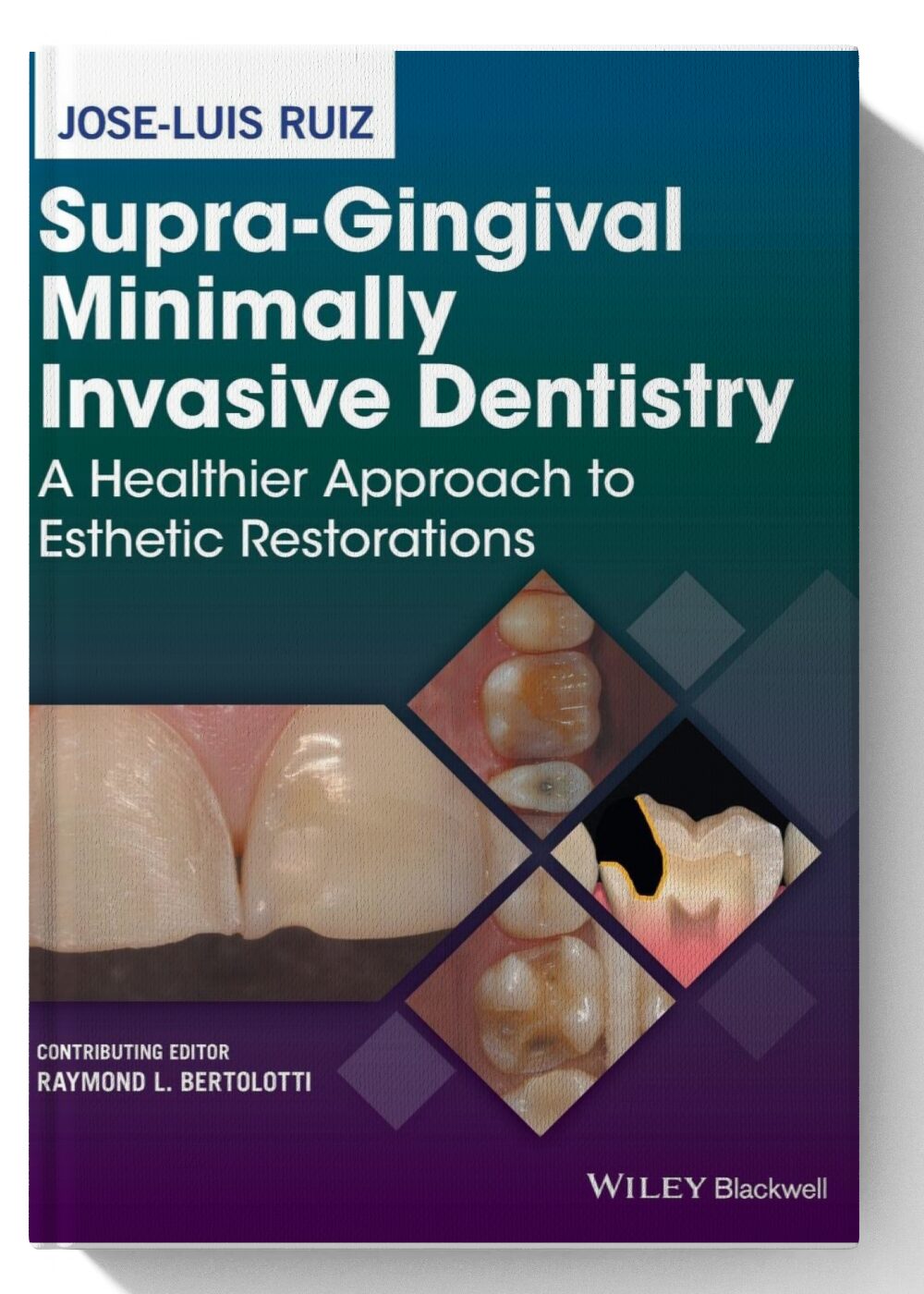 Supra-Gingival Minimally Invasive Dentistry: A Healthier Approach to Esthetic Restorations 1st Edition