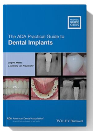 The ADA Practical Guide to Dental Implants 1st Edition
