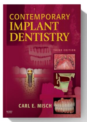 Contemporary Implant Dentistry - E-Book 3rd Edition