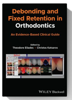 Debonding and Fixed Retention in Orthodontics: An Evidence-Based Clinical Guide 1st Edition