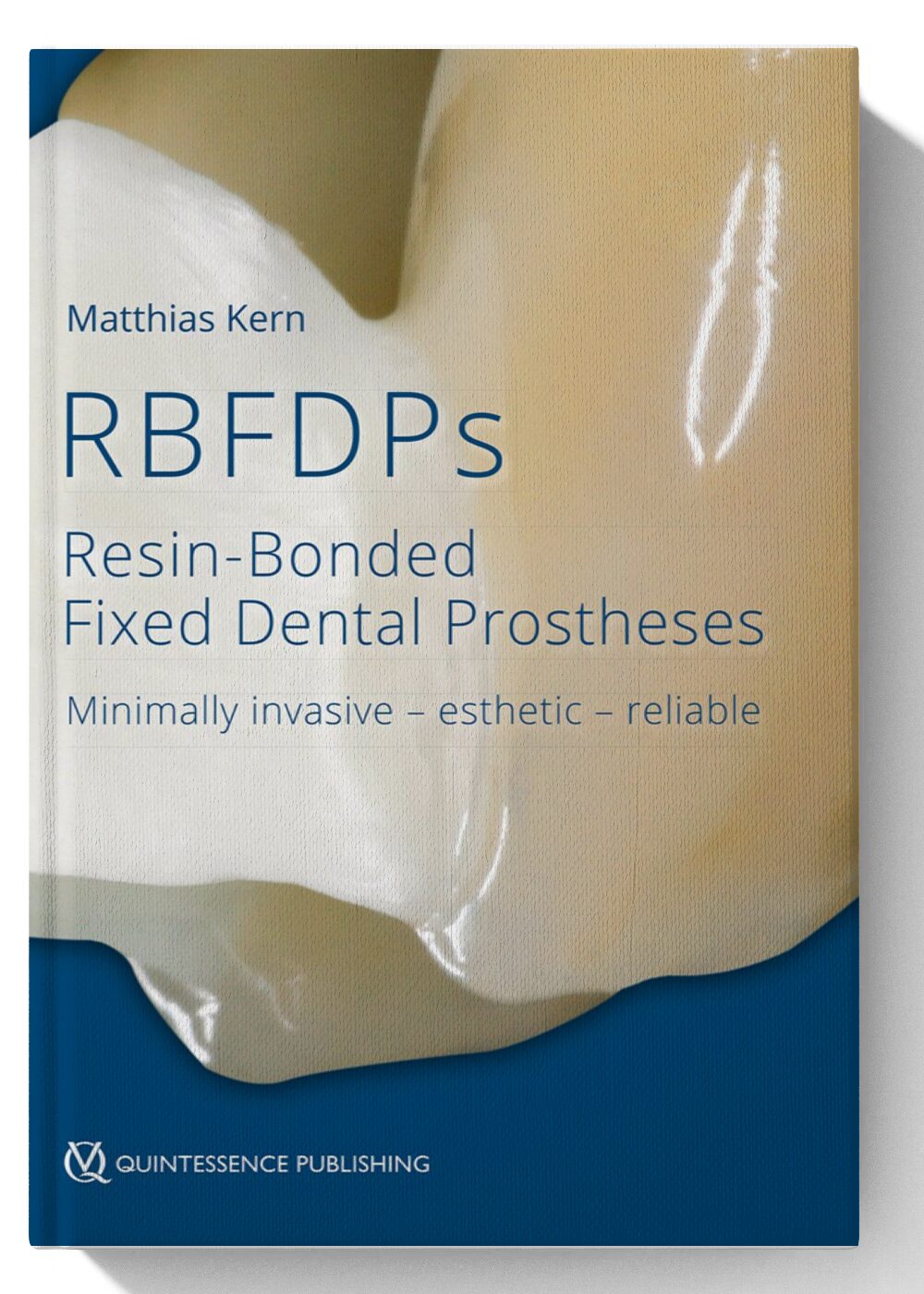 Resin-Bonded Fixed Dental Prostheses: Minimally invasive – esthetic – reliable 1st Edition