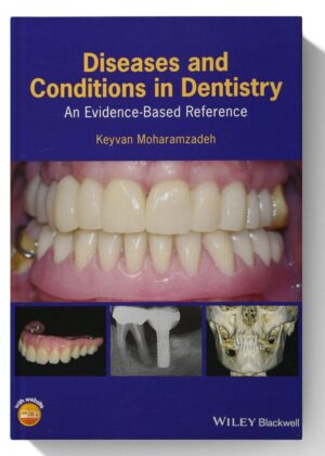 Diseases and Conditions in Dentistry: An Evidence-Based Reference 1st Edition