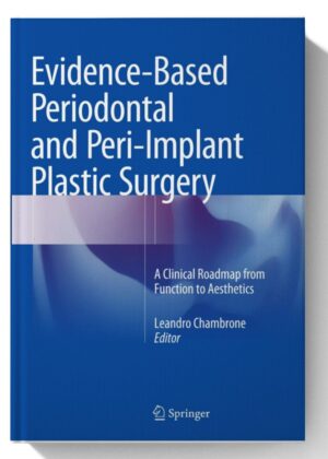 Evidence-Based Periodontal and Peri-Implant Plastic Surgery: A Clinical Roadmap from Function to Aesthetics Softcover reprint of the original 1st ed