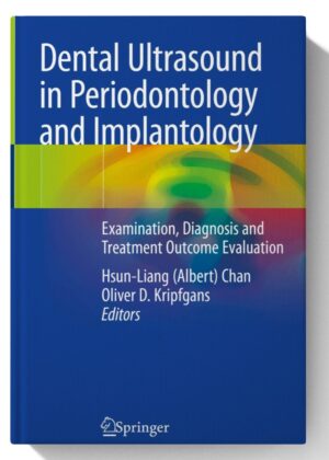 Dental Ultrasound in Periodontology and Implantology: Examination, Diagnosis and Treatment Outcome Evaluation 1st ed. 2021 Edition