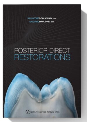 Posterior Direct Restorations Kindle Edition