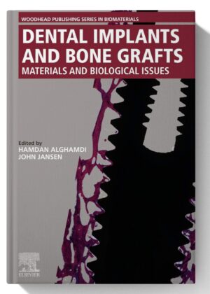 Dental Implants and Bone Grafts: Materials and Biological Issues 1st Edition