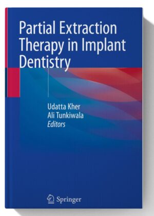 Partial Extraction Therapy in Implant Dentistry 1st ed. 2020 Edition