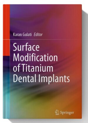 Surface Modification of Titanium Dental Implants 2023rd Edition