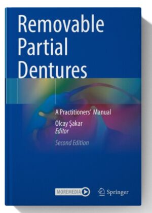 Removable Partial Dentures: A Practitioners’ Manual 2nd Edition (May 17, 2024)