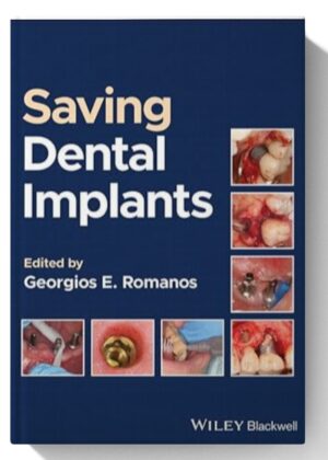 Saving Dental Implants 1st Edition