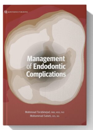 Management of Endodontic Complications: From Diagnosis to Prognosis