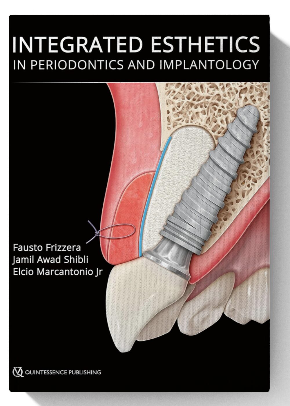 Integrated Esthetics in Periodontics and Implantology 1st Edition