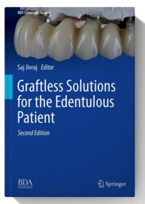 Graftless Solutions for the Edentulous Patient (BDJ Clinician’s Guides) 2nd Edition (July 21, 2023)